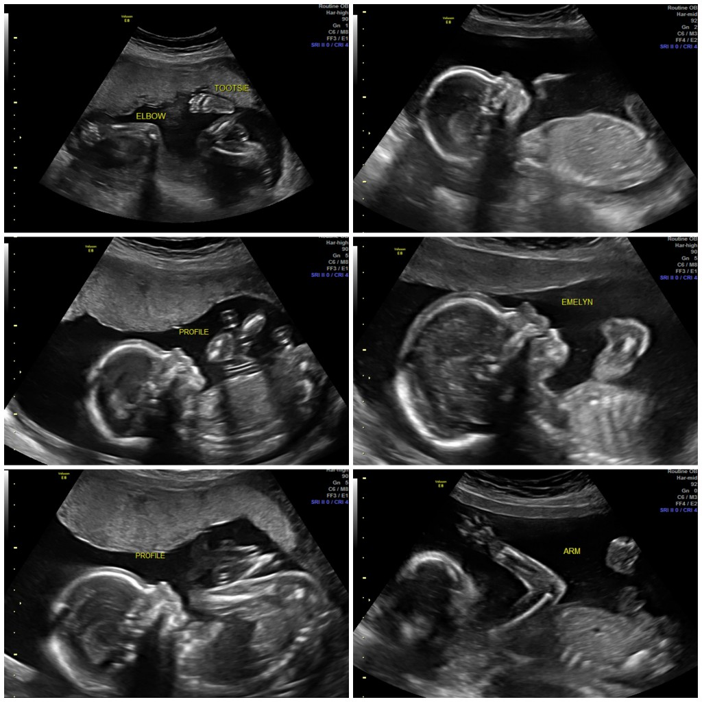 PicMonkey Collage 20 week