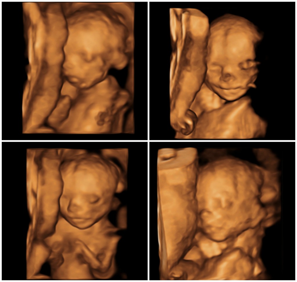 PicMonkey Collage 20 weeks-2